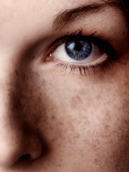 Come togliere posti di pigmentary su una faccia di crema